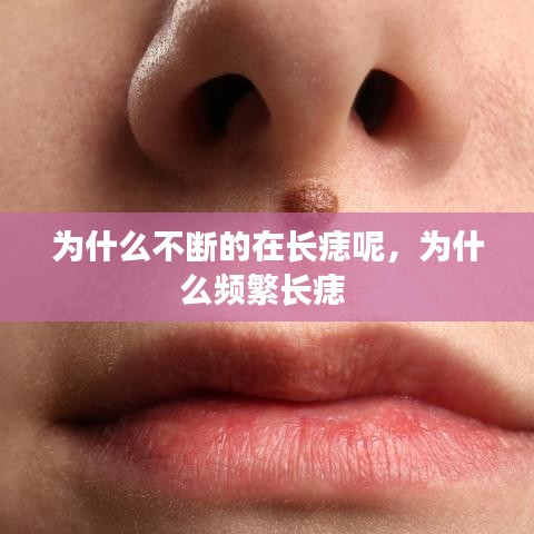 为什么不断的在长痣呢，为什么频繁长痣 