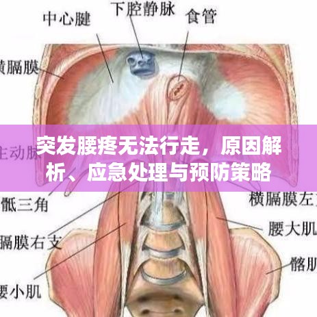 突发腰疼无法行走，原因解析、应急处理与预防策略