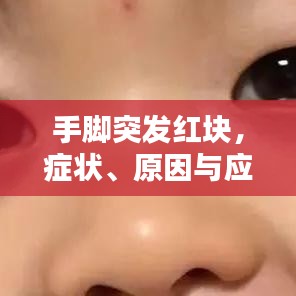 手脚突发红块，症状、原因与应对方法全解析