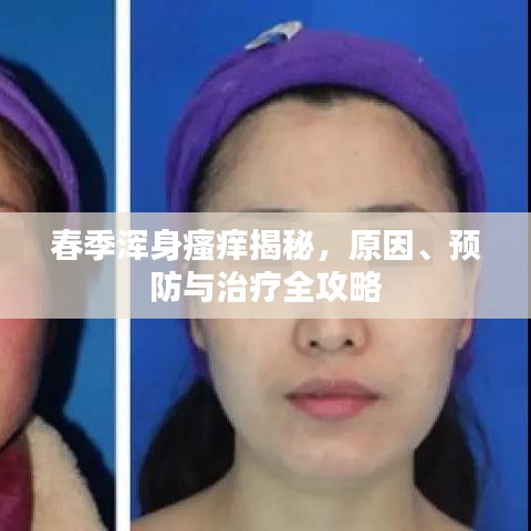 春季浑身瘙痒揭秘，原因、预防与治疗全攻略